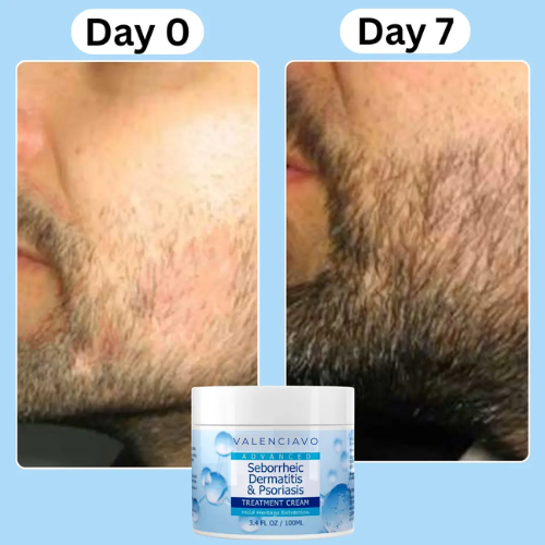 Beard Relief Cream